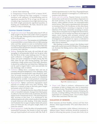v. Severe chest indrawing
vi. Temperature of more than 37.5°
C or below 35.5°
C
• A date for followup has been assigned. A normal
newborn with adequacy of breastfeeding and no
significant jaundice by 72 hr of age can be seen at
6 weeks of age. In presence of any high risk factor (e.g.
low birth weight, prematurity significant jaundice, or
feeding not established), the baby should be seen
within 2-3 days of discharge.
Common Parental Concerns
• Weight loss in first week: Normally babies lose 8-10% of
birth weight in the first week of life which is regained
by 7-10 days age. Subsequently there should be a gain
of 20 to 40 g per day.
• Cryingduringmicturition: The sensation of a full bladder
is uncomfortable to many babies who cry before passing
urine and they quieten as soon as micturition starts.
Crying during passage of urine as opposed to before the
act of rnicturitionshouldalert clinician to thepossibility
of urinary tract infection.
• Bathing: During the first week, till cord falls off, only
sponging is recommended which can be given after
the first 24 hr of life. Later, bathing every 2-3 days is
quite sufficient. A draught-free warm room, warm
water and quick completion of bath ensure that the
baby does not get cold during bathing. The head
constitutes a large surface area of the baby; therefore,
it should be washed last and dried first. Bathing time
can be used to inspect baby's cord, eyes and skin for
any discharge, rash or redness.
• Cosmetics: Babies have a sensitive skin and use of
cosmetics should beminimized. A low alkalinity, mild,
non-perfumed/non-medicated soap should be used.
Any oil except mustard oil can be used. Sprinkling
talcum powder on babies can result in its inhalation
and should be avoided. Avoid products containing
boric acid (present in most prickly heat preparations).
• Regurgitation: Babies commonly regurgitate small
amount of curdled milk soon after feeding. This
behavior is normal as long as the baby gains weight
and passes urine 6-8 times a day.
• Frequentstools: During the first few days oflife, thestool
color in breastfed neonates changes from black-green
to yellow by the end offirst week. In between, thestools
appear loose ('transitional stools'). The stool frequency
may increase at this time. It is attributed to the
enhanced gastrocolic reflex which results inthepassage
of small stools just after feeding. If the baby remains
well hydrated, has no signs of sepsis, feeds well, passes
urine 6-8 times per day and gains weight, there is no
cause for concern.
• Breast engorgement: Under the effect of transplacentally
transmitted hormones, the breasts in boys and girls
may get hypertrophied and secrete milk like fluid. It
Newborn Infants -
resolvesspontaneouslyin a few days. Engorgedbreasts
should not be sqeezed or massaged as it could lead to
soreness and infection.
• Rashes and skin peeling: Papular lesions on erythe­
matous basecanbe seeninmanybabies; dispersed over
the trunk and face, on day two or three of life. These
lesions, called erythema toxicum, are eosinophil-laden
sterile lesions. Theyresolve spontaneously andrequire
no treatment (Fig. 8.12). Pyoderma, on the other hand,
are pus-filled lesions occurring in response to local
infection of the skin, commonly occurring in creases
where dirtaccumulatessuch as thigh fold, backof neck,
etc. If boils are <10 in number and there are no signs of
sepsis, local cleaning with antiseptic solution and
application of 1.0% gentian violet is sufficient. Further
investigation and treatment for sepsis is indicated if
there are >10 lesions, signs of sepsis or non-resolution
after topical treatment.
Skin peeling is another normal skin finding noted
especiallyinpost-termand IUGRbabies.Oilmassaging
can decrease the flaking and no other intervention is
required.
Fig. 8.12: Erythema toxicum
• Diaper rash: There is redness, inflammation and
excoriation of skin in diaper area due to maceration
by stools and urine. The problem is more frequent with
plastic nappies. The treatment consists of keeping the
area dry, avoiding rubbing of the skin for cleaning and
application of a soothing cream. Use of cotton diaper
is less often associated with this rash.
EVALUATION OF NEWBORN
Most neonates are born healthy, normal and free from
disease. Some (approximately 10%) need observation in
nursery.
Newborn examination yields different information at
different times. Hence, newborns should be examined in
detail at following time points: (i) soon after birth, (ii) at
 