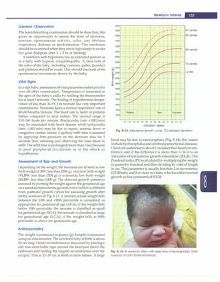 General Observation
The least disturbing examination should be done first; this
gives an opportunity to assess the state of alertness,
posture, spontaneous activity, color, any obvious
respiratory distress or malformation. The newborns
should be examined when they are inlightsleep or awake
but quiet (happens after 1-1.5 hr of feeding).
A newborn with hypotonia has an extended posture as
in a baby with hypoxic encephalopathy. A clear note of
the color of the baby, including cyanosis, pallor, jaundice
and plethora should be made. One should also look at the
spontaneous movements shown by the baby.
Vital Signs
In a sick baby, assessment of vitalparameterstakespriority
over all other examination. Temperature is measured in
the apex of the baby's axilla by holding the thermometer
for at least 3 minutes. The finding of hypothermia (tempe­
rature of less than 36.5°
C) in neonate has very important
connotations. Neonates have a normal respiratory rate of
40-60 breaths/minute. The heart rate is faster in preterm
babies compared to term babies. The normal range is
110-160 beats per minute. Bradycardia (rate <100/min)
may be associated with heart disease while tachycardia
(rate >160/min) may be due to sepsis, anemia, fever or
congestive cardiac failure. Capillary refill time is assessed
by applying firm pressure on the sternum area for 5
seconds than releasing and observing the time taken to
refill. The refill time isprolonged (more than3 sec)because
of poor peripheral circulation as in the shock or
hypothermia.
Assessment of Size and Growth
Depending on the weight, the neonates are termed as low
birthweight (LBW, less than 2500 g), very low birth weight
(VLBW, less than 1500 g) or extremely low birth weight
(ELBW, less than 1000 g). The aberrant growth pattern is
assessed by plotting the weight against the gestational age
on astandardintrauterinegrowthcurve (which is different
from postnatal growth curves for assessing growth after
birth), as shown in Fig. 8.13. A neonate whose weight falls
between the 10th and <90th percentile is considered as
appropriate for gestational age (AGA); if the weight falls
below 10th percentile, the neonate is classified as small
for gestational age (SGA); theneonate is classified as large
for gestational age (LGA), if the weight falls at 90th
percentile or above for gestational age.
Anthropometry
The weight is measured in grams (g). Length is measured
using aninfantometer. The newborn baby at birth is about
50 cm long. Head circumference is measured by placing a
soft non-stretchable tape around the head just above the
eyebrows and finding the largest circumference over the
occiput. This is 33-37 cm at birth in term babies. A large
4000
3800
3600
3400
3200
3000
2800
2600
�2400
:E 2200
-� 2000
� 1800
co
1600
1400
1200
1000
800
600
Newborn Infants
..
ft ...-- �
�
·l-+- I
I
-r I
f -1-
-t-
1 t..
t + ..
T
� ..... +
l t- ;.._ .. +
�
Preterm Term Post-term
31 32 33 34 35 36 37 38 39 40 41 42 43 44
Gestation, weeks
-
97 centile
90 centile
-
50 centile
10 centile
-2 SD
Fig. 8.13: Intrauterine growth curves. SD standard deviation
head may be due to macrocephaly (Fig. 8.14), the causes
includehydrocephalusandcerebralparenchymaldiseases.
Chest circumference isabout3cmlesserthanheadcircum­
ference and if the difference is more than 3 cm it is an
indication of intrauterine growth retardation (IUGR). The
Pondera!index (Pl)iscalculatedbymultiplyingtheweight
in grams by hundred and then dividing by cube of length
in cm. This parameter is usually less than 2 in asymmetric
IUGR baby and 2 or more in a baby who has either normal
growth or has symmetrical IUGR.
Fig. 8.14: A newborn infant with large head (macrocephaly). Note
bossings of both frontal eminences
 