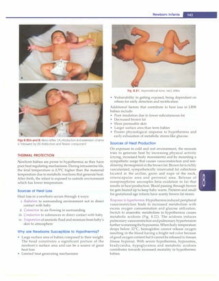 -----------------------------------N_e_w_b_o_rn_in_f_a_n _ts
.....
-
Figs 8.20A and B: Moro reflex (A) Abduction and extension of arms
is followed by (B) Adduction and flexion component
THERMAL PROTECTION
Newborn babies are prone to hypothermia as they have
poorheatregulating mechanisms. During intrauterinelife,
the fetal temperature is 0.5°
C higher than the maternal
temperature due to metabolic reactions that generate heat.
After birth, the infant is exposed to outside environment
which has lower temperature.
Sources of Heat Loss
Heat loss in a newborn occurs through 4 ways:
i. Radiation to surrounding environment not in direct
contact with baby
ii. Convection to air flowing in surrounding
iii. Conduction to substances in direct contact with baby
iv. Evaporationofamnioticfluidandmoisturefrom baby's
skin to atmosphere
Why are Ne wborns Susceptible to Hypothermia?
• Large surface area of babies compared to their weight:
The head constitutes a significant portion of the
newborn's surface area and can be a source of great
heat loss
• Limited heat generating mechanisms
Fig. 8.21: Asymmetrical tonic neck reflex
• Vulnerability to getting exposed, being dependant on
others for early detection and rectification
Additional factors that contribute to heat loss in LBW
babies include:
• Poor insulation due to lower subcutaneous fat
• Decreased brown fat
• More permeable skin
• Larger surface area than term babies
• Poorer physiological response to hypothermia and
early exhaustion of metabolic stores like glucose.
Sources of Heat Productio
n
On exposure to cold and wet environment, the neonate
tries to generate heat by increasing physical activity
(crying, increased body movements) and by mounting a
sympathetic surge that causes vasoconstriction and non­
shivering thermogenesis in the brownfat. Brown fat is richly
vascularized, sympathetically innervated fat collections
located in the axillae, groin and nape of the neck,
interscapular area and perirenal area. Release of
norepinephrine uncouples beta-oxidation in fat that
results in heat production. Blood passing through brown
fat gets heated up to keep baby warm. Preterm and small
for gestational age infants have scanty brown fat stores.
Response to hypothermia. Hypothermiainduced peripheral
vasoconstriction leads to increased metabolism with
excess oxygen consummation and glucose utilization.
Switch to anaerobic metabolism in hypothermia causes
metabolic acidosis (Fig. 8.22). The acidosis induces
pulmonary vasoconstrictionandpulmonary hypertension
furtherworseningthehypoxemia. Whenbodytemperature
drops below 32°
C, hemoglobin cannot release oxygen
resulting in the blood having a bright red color because
of good oxygen content but it cannot be released to tissues
(tissue hypoxia). With severe hypothermia, hypoxemia,
bradycardia, hypoglycemia and metabolic acidosis
contributes towards increased mortality in hypothermic
babies.
 