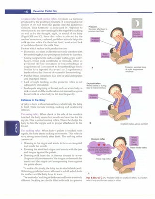 __E
_
s
_
s
_
e
_
n
_
t
_
ia
_
i
_
P
_
e
_
d
_
i
_
a
_
tr
_
ic
_
s_________________________________
Oxytocin reflex (milkejection reflex). Oxytocin is a hormone
produced by the posterior pituitary. It is responsible for
ejection of the milk from the glands into the lactiferous
sinuses. This hormone is produced in response to
stimulation to the nerve endings in the nipple by suckling
as well as by the thought, sight, or sound of the baby
(Figs 8.308 and C). Since this reflex is affected by the
mother's emotions, a relaxed, confident attitude helps the
milk ejection reflex. On the other hand, tension and lack
of confidence hinder the milk flow.
Factors which reduce milk production are:
• Dummies, pacifiers and bottles not only interfere with
breastfeeding but also predispose the baby to diarrhea.
• Giving supplements such as sugar water, gripe water,
honey, breast milk substitutes or formula, either as
prelacteal (before initiation of breastfeeding) or
supplemental (concurrent to breastfeeding) feeds.
Studies have reported that even 1 or 2 supplemental
feeds reduce the chances of successful breastfeeding.
• Painful breast conditions like sore or cracked nipples
and engorged breast.
• Lack of night feeding, as the prolactin reflex is not
adequately stimulated.
• Inadequate emptying of breast such as when baby is
sick or small andthe mother doesnot manually express
breast milk or when baby is fed less frequently.
Reflexes in the Baby
A baby is born with certain reflexes which help the baby
to feed. These include rooting, sucking and swallowing
reflexes.
The rooting reflex. When cheek or the side of the mouth is
touched, the baby opens her mouth and searches for the
nipple. This is called rooting reflex. This reflex helps the
baby to find the nipple and in proper attachment to the
breast.
The suckling reflex. When baby's palate is touched with
nipple, the baby starts sucking movements. This reflex is
very strong immediately after birth. The sucking reflex
consists of:
• Drawing in the nipple and areola to form an elongated
teat inside the mouth.
• Pressing the stretched nipple and areola with the jaw
and tongue against the palate.
• Drawing milk from the lactiferous sinuses by wave­
like peristalticmovement of the tongue underneath the
areola and the nipple and compressing them against
the palate above.
To suckle effectively, the baby has to attach (latch) well.
Obtaining good attachment at breast is a skill, which both
the mother and the baby have to learn.
The method of suckling at the breast and bottleis entirely
different. Suckling on a bottle filled with milk is a passive
Prolactin
Secreted after feed to
produce next feed
Prolaclin
in blood
A
Oxytocin reflex
Works before or during
feed to make milk flow
C
Oxytocin
in blood
B
These help reflex
Sensory
impulses
from niP.P.le
Prolactin: secreted more
at night; suppresses
ovulation
Oxytocin makes uterus contract
Figs 8.30A to C: (A) Prolactin and (B) oxytocin reflex; (C) factors
which help and hinder oxytocin reflex
 