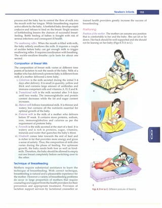 process and the baby has to control the flow of milk into
the mouth with her tongue. While breastfeeding requires
active efforts by the baby. A bottlefed baby develops nipple
confusion and refuses to feed on the breast. Single session
of bottlefeeding lessens the chances of successful breast­
feeding. Bottle feeding of babies is fraught with risk of
serious infections and consequent ill health.
The swallowing reflex. When the mouth is filled with milk,
the baby reflexly swallows the milk. It requires a couple
of suckles before baby can get enough milk to trigger
swallowing reflex. It requirescoordination with breathing.
The suckle-swallow-breathe cycle lasts for about one
second.
Composition of Breast Milk
The composition of breast milk varies at different time
points of lactation to suit the needs of the baby. Milk of a
mother who hasdeliveredapreterm baby isdifferentfrom
milk of a mother delivered a term baby.
i. Colostrum is the milk secreted during the initial 3--4
days after delivery. It is small in quantity, yellow and
thick and contains large amount of antibodies and
immune-competant cells and vitamins A, D, E and K.
ii. Transitional milk is the milk secreted after 3-4 days
until two weeks. The immunoglobulin and protein
content decreases while the fat and sugar content
increases.
iii. Mature milk follows transitional milk. It is thinner and
watery but contains all the nutrients essential for
optimal growth of the baby.
iv. Preterm milk is the milk of a mother who delivers
before 37 week. It contains more proteins, sodium,
iron, immunoglobulins and calories as per the
requirement of preterm baby.
v. Foremilk is the milk secreted at the start of a feed. It is
watery and is rich in proteins, sugar, vitamins,
minerals and water that quenches the baby's thirst.
vi. Hindmilk comes later towards the end of feed and
is richer in fat that provides more energy and gives
a sense of satiety. Thus, the composition of milk also
varies during the phase of feeding. For optimum
growth, the baby needs both fore as well as hind­
milk. Therefore, the baby should be allowed to empty
out one breast completely before switching over to
the other.
Technique of Breastfeeding
Mothers require substantial assistance to learn the
technique of breastfeeding. With correct technique,
breastfeeding is natural and a pleasurable experience for
the mother. However a variety of breastfeeding problems
do occur in large proportion of mothers that require
counselingand supportfromthe healthprovidersfortheir
prevention and appropriate treatment. Provision of
lactation support services by lactational counsellor or
Newborn Infants -
trained health providers greatly increase the success of
breastfeeding.
Positioning
Position ofthe mother. The mother can assume any position
that is comfortable to her and the baby. She can sit or lie
down. Her back should be well supported and she should
not be leaning on her baby (Figs 8.31A to C).
C
Figs 8.31A to C: Different postures of feeding
 