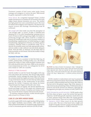 Treatment consists of local warm water packs, breast
massage and analgesics to relieve the pain. Milk should
be gently expressed to soften the breast.
Breast abscess. If a congested engorged breast, cracked
nipple, blockedduct or mastitis are nottreatedin the early
stages, breast abscess formation can occur. The mother
has high grade fever and a raised blood count. She must
be treatedwith analgesics and antibiotics.The abscess may
require incision and drainage. Breastfeeding must be
continued.
Not enough milk. First make sure that the perception of
"not enough milk" is correct. If baby is satisfied and
sleeping for 2-3 hr after breastfeeding, passing urine at
least 6-8times in 24 hr and gaining weight, the mother is
producing enough milk. There could be a number of
reasons for insufficient milk such as incorrect method of
breastfeeding, supplementary or bottle feeding, no night
breastfeeding, engorgement of breast, any illness, painful
condition, maternal stress or insufficient sleep. Try to
Newborn Infants -
Step 2
identify the possible reason and take appropriate actions. Step 3
Advise mother to take sufficient rest and drink adequate
fluids. Feed the baby on demand. Let the baby feed as
long as possible on each breast. Advisethe mother to keep
the baby with her.
Expressed Breast Milk (EBM)
If a mother is not in a position to feed her baby (e.g. ill
mother, preterm baby, working mother, etc.), she should
express her milk in a clean wide-mouthed container and
this milk should be fed to her baby. EBM can be stored at
room temperature for 6-8 hr, in a refrigerator for 24 hr
and a freezer at -20°
C for 3 months.
Method of Milk Expression
Ask the mother to wash her hands thoroughly with soap
and water before she expresses. She should make herself
comfortable. Gently massage the breast (Fig. 8.35). Hold
thecontainerunder her nipple and areola. Place herthumb
on top of the breast at least 4 cm from the tip of the nipple
and the first finger on the undersurface of the breast
opposite the thumb. Compress and release the breast
tissue between her fingers and thumb a few times.
If the milk does not appear, she should reposition her
thumb and finger closer to the nipple and compress and
release the breast as before. Compress and release all the
way around the breast. Express milk from both breasts.
To maintain adequate lactation, mother should express
milk at least 8 to 10 times in 24 hr.
CARE OF LOW BIRTH WEIGHT BABIES
Lowbirthweight(LBW;birthweightlessthan2500g)babies
have higher morbidity and mortality. LBW results from
eitherpretermbirth (before37completedweeksofgestation)
or due to intrauterine growth restriction (IUGR) or both.
Step4
Fig. 8.35: Four steps of breast milk expression. Step 1: Massage the
breasts gentlytoward the nipples; Step 2: Place the thumb and index
finger opposite each other just outside the dark circle around the
nipple; Step 3: Press back toward the chest, then gently squeeze to
release milk; Step 4: Repeat step 3 in different positions around the
areola
IUGR is similar to malnutrition and may be present in
bothterm andpreterminfants.NeonatesaffectedbyIUGR
are usually undernourished and have loose skin folds on
the face and in the gluteal region (Fig. 8.36), absence of
subcutaneous fat and peeling ofskin. Problemsfaced by a
preterm and IUGR neonate are different, although the
management principles are common to both (Table 8.12).
IUGR (Intrauterine growth restriction). IUGR results when
the fetus does not grow as per the normal fetal growth
trajectory. IUGR fetal growth restriction results from one
or many adverse factors that affect the normal growth
pattern of the fetuses.There are two types of IUGR babies:
• Symmetric IUGR: When insult on the fetal growth
occurs early. The size of the head, body weight and
length areequally reduced. Causes include genetic and
chromosomal disorders or TORCH infections.
 