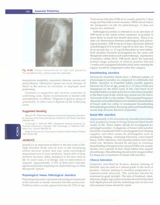 __E_s_s_e_n_ t_ia_l_P_e_d_ i_a _tr_ic_s________________________________
Fig. 8.48: Tension pneumothorax on right side displacing
the mediastinum and pushing down the diaphragm
temperature instability, respiratory distress, anemia and
polycythemia. Obstructive apnea can occur because of
block to the airway by secretion or improper neck
positioning.
Treatment is supportive and involves correction of
underlying cause. Apnea of prematurity is treated with
aminophylline or caffeine. Prognosis is good in apnea of
prematurity. In other cases it depends on the underlying
cause.
Suggested Reading
Bhutani VI<. Differential diagnosis ofneonatal respiratory disorders.
In: Intensive of the Fetus and Neonate. Ed Spitzer AR. Mosby Year Book
1996;494-505
Greenough A, Roberton MRC. Respiratory distress syndrome. In:
Neonatal Respiratory Disorders. Eds Greenough A, Roberton NRC,
Milner AD. Arnold 1996;238-79
Singh M,Deorari AK. Pneumonia in newborn babies.IndianJ Pediatr
1995; 62:293-306
JAUNDICE
Jaundice is an important problem in the first week of life.
High bilirubin levels may be toxic to the developing
central nervous system and may cause neurological
impairment even in term newborns. Nearly 60% of term
newborn becomes visibly jaundiced in the first week of
life. In most cases, it is benign and no intervention is
required. Approximately 5-10% of them have clinically
significantjaundice requiringuse ofphototherapyorother
therapeutic options.
Physiological Versus Pathological Jaundice
Physiological jaundice represents physiologicalimmaturity
of the neonates to handle increased bilirubin production.
Visible jaundice usually appears between 24-72 hr of age.
Total serum bilirubin (TSB) level usually peaks by 3 days
of age and then falls in termneonates. TSBlevels are below
the designated cut-offs for phototherapy. It does not
require any treatment.
Pathological jaundice is referred to as an elevation of
TSB levels to the extent where treatment of jaundice is
more likely to result into benefit than harm. There is no
clear cut demarcation between pathological and physio­
logical jaundice. TSB levels have been arbitrarily defined
as pathological if it exceeds 5 mg/dl on first day, 10 mg/
dl on second day, or 15 mg/dl thereafter in term babies.
Such jaundice warrants investigation for the cause and
therapeuticinterventionsuchasphototherapy. Appearance
of jaundice within 24 hr, TSB levels above the expected
normal range, presence of clinical jaundice beyond
3 weeks and conjugated bilirubin (dark urine staining the
nappy) would be categorized under this category.
Breastfeeding Jaundice
Exclusively breastfed infants have a different pattern of
physiological jaundice as compared to artificially-fed
babies. Jaundice in breastfed babies usually appears
between 24-72 hr of age, peaks by 5-15 days of life and
disappears by the third week of life. One-third of all
breastfed babiesaredetectedtohave mildclinical jaundice
in the third week of life, which may persist into the 2nd to
3rd month of life in a few babies. This increased frequency
ofjaundicein breastfedbabiesisnotrelatedtocharacteristics
of breast milk but rather to inadequate breastfeeding
(breastfeeding jaundice). Ensuring optimumbreastfeeding
would help decrease this kind of jaundice.
Breast Milk Jaundice
Approximately 2-4% of exclusively breastfed term babies
have jaundice in excess of 10 mg/dl beyond third-fourth
weeks of life. These babies should be investigated for
prolonged jaundice. A diagnosis of breast milk jaundice
should be considered if this is unconjugated (not staining
nappies); and other causes for prolongation such as
inadequate feeding, continuing hemolysis, extravasated
blood, G6PD deficiency and hypothyroidism have been
ruled out. Mothers should be advised to continue
breastfeeding at frequent intervalsandTSBlevels usually
decline over a period of time. Some babies may require
phototherapy. Breastfeeding should not be stopped either
for diagnosis or treatment of breast milk jaundice.
Clinical Estimation
Originally described by Kramer, dermal staining of
bilirubin may be used as a clinical guide to the level of
jaundice. Dermal staining in newborn progresses in a
cephalocaudal direction. The newborn should be
examined in good daylight. The skin of forehead, chest,
abdomen,thighs,legs,palmsandsolesshould be blanched
with digital pressure and the underlying color of skin and
subcutaneous tissue should be noted.
 