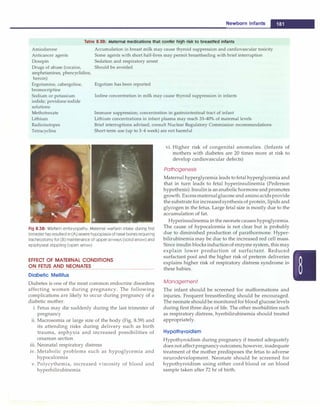 Newborn Infants -
Table 8.28: Maternal medications that confer high risk to breastfed infants
Amiodarone
Anticancer agents
Doxepin
Accumulation in breast milk may cause thyroid suppression and cardiovascular toxicity
Some agents with short hall-lives may permit breastfeeding with brief interruption
Sedation and respiratory arrest
Drugs of abuse (cocaine,
amphetamines, phencyclidine,
heroin)
Ergotamine, cabergoline,
bromocriptine
Should be avoided
Ergotism has been reported
Sodium or potassium
iodide; povidone-iodide
solutions
Iodine concentration in milk may cause thyroid suppression in infants
Methotrexate Immune suppression; concentration in gastrointestinal tract of infant
Lithium Lithium concentrations in infant plasma may reach 33-40% of maternal levels
Radioisotopes
Tetracycline
Brief interruptions advised; consult Nuclear Regulatory Commission recommendations
Short-term use (up to 3-4 week) are not harmful
Fig 8.58: Warfarin embryopathy. Maternal warfarin intake during first
trimester has resulted in CA) severe hypoplasia of nasal bones requiring
tracheostomy for (B) maintenance of upper airways (solid arrow) and
epiphyseal stippling (open arrow)
EFFECT OF MATERNAL CONDITIONS
ON FETUS AND NEONATES
Diabetic Mellitus
Diabetes is one of the most common endocrine disorders
affecting women during pregnancy. The following
complications are likely to occur during pregnancy of a
diabetic mother.
i. Fetus may die suddenly during the last trimester of
pregnancy
ii. Macrosomia or large size of the body (Fig. 8.59) and
its attending risks during delivery such as birth
trauma, asphyxia and increased possibilities of
cesarean section
iii. Neonatal respiratory distress
iv. Metabolic problems such as hypoglycemia and
hypocalcemia
v. Polycythemia, increased viscosity of blood and
hyperbilirubinemia
vi. Higher risk of congenital anomalies. (Infants of
mothers with diabetes are 20 times more at risk to
develop cardiovascular defects)
Pathogenesis
Maternal hyperglycemia leads to fetal hyperglycemia and
that in turn leads to fetal hyperinsulinemia (Pederson
hypothesis).Insulinis ananabolichormoneand promotes
growth. Excessmaternalglucose and aminoacidsprovide
the substrate for increasedsynthesisof protein, lipids and
glycogen in the fetus. Large fetal size is mostly due to the
accumulation of fat.
Hyperinsulinemia in the neonate causes hypoglycemia.
The cause of hypocalcemia is not clear but is probably
due to diminished production of parathormone. Hyper­
bilirubinemia may be due to the increased red cell mass.
Since insulin blocks inductionof enzyme system, this may
explain lower production of surfactant. Reduced
surfactant pool and the higher risk of preterm deliveries
explains higher risk of respiratory distress syndrome in
these babies.
Management
The infant should be screened for malformations and
injuries. Frequent breastfeeding should be encouraged.
The neonate should be monitoredfor blood glucose levels
during first three days of life. The other morbidities such
as respiratory distress, hyerbilirubinemia should treated
appropriately.
Hypothyroidism
Hypothyroidism during pregnancy if treated adequately
does not affectpregnancyoutcomes; however, inadequate
treatment of the mother predisposes the fetus to adverse
neurodevelopment. Neonate should be screened for
hypothyroidism using either cord blood or on blood
sample taken after 72 hr of birth.
 