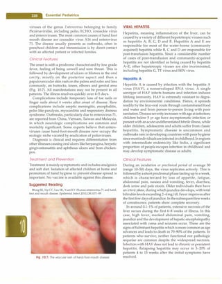 - Essential Pediatrics
viruses of the genus Enterovirus belonging to family
Picornaviridae, including polio, ECHO, coxsackie virus
and enteroviruses. The most common causes of hand foot
mouth disease are coxsackie virus A16 and enterovirus
71. The disease usually presents as outbreaks, often in
preschool children and transmission is by direct contact
with an affected patient or infected fomites.
Clinical Features
The onset is with a prodrome characterized by low grade
fever, feeling of being unwell and sore throat. This is
followed by development of ulcers or blisters in the oral
cavity, mostly on the posterior aspect and then a
papulovesicular skin rash on the palms and soles and less
commonly, on buttocks, knees, elbows and genital area
(Fig. 10.7). All manifestations may not be present in all
patients. The illness resolves quickly over 4-5 days.
Complications include temporary loss of toe nails or
finger nails about 4 weeks after onset of disease. Rare
complications include aseptic meningitis, encephalitis,
polio like paralysis, myocarditis and respiratory distress
syndrome. Outbreaks, particularly due to enterovirus 71,
are reported from China, Vietnam, Taiwan and Malaysia,
in which neurologic complications are common and
mortality significant. Some experts believe that entero­
viruses cause hand-foot-mouth disease now occupy the
ecologic niche vacated by eradication of polioviruses.
Diagnosis is clinical and requires differentiation from
other illnessescausing oral ulcers like herpangina,herpetic
gingivostomatitis and aphthous ulcers and from chicken­
pox.
Treatment and Prevention
Treatment is mainly symptomatic and includes analgesics
and soft diet. Isolation of affected children at home and
promotion of hand hygiene to prevent disease spread is
important. No vaccine is available against this disease.
Suggested Reading
Wong 55, Yip CC, Lau SK, Yuen KY. Human enterovirus 71 and hand,
foot and mouth disease. Epidem.iol Infect 2010;138:1071---89
Fig. 10.7: The vesicular rash of hand-foot-mouth disease
VIRAL HEPATITIS
Hepatitis, meaning inflammation of the liver, can be
caused by a variety of different hepatotropic viruses such
as hepatitis A, B, C, D and E. Hepatitis A and E are
responsible for most of the water-borne (community
acquired) hepatitis while B, C and D are responsible for
post-transfusion hepatitis. Since a considerable number
of cases of post-transfusion and community-acquired
hepatitis are not identified as being caused by hepatitis
A-E, other hepatotropic viruses are also incriminated,
including hepatitis G, TI virus and SEN virus.
Hepatitis A
Hepatitis A is caused by infection with the hepatitis A
virus (HAV), a nonenveloped RNA virus. A single
serotype of HAV infects humans and infection induces
lifelong immunity. HAV is extremely resistant to degra­
dation by environmental conditions. Hence, it spreads
readily by the feco-oral route through contaminated food
and water and from person-to-person living with poor
sanitation.Diseaseseverity increases withage at infection;
children below 5 yr age have asymptomatic infection or
present withanacuteundifferentiated febrile illness, while
older children, adolescents and adults suffer from classic
hepatitis. Symptomatic disease is uncommon and
outbreaks rare indeveloping countries with poor hygiene
since mostindividualsareinfected inchildhood. Inregions
with intermediate endemicity like India, a significant
proportion of people escapes infection in childhood and
may develop symptomatic disease as adults.
Clinical Features
During an incubation or preclinical period of average 30
(range 10-50) days, the virus replicates actively. This is
followed by ashortprodromalphaselastingup to a week,
which is characterized by loss of appetite, fatigue,
abdominal pain, nausea and vomiting, fever, diarrhea,
dark urine and pale stools. Older individuals then have
an ictericphase, duringwhichjaundicedevelops, with total
bilirubinlevelsexceeding2-4 mg/dl. Fever improvesafter
the first few days ofjaundice.In thesubsequentfew weeks
of convalescence, patients show complete recovery.
In around 0.1-1% of patients, extensive necrosis of the
liver occurs during the first 6-8 weeks of illness. In this
case, high fever, marked abdominal pain, vomiting,
jaundice and the development of hepatic encephalopathy
associated with coma and seizures occur. These are the
signs of fulminant hepatitis which is more common as age
advances and leads to death in 70-90% of the patients. In
patients who survive, neither functional nor pathologic
sequelae are common despite the widespread necrosis.
Infection with HAV does not lead to chronic or persistent
hepatitis. Relapsing hepatitis may occur in 3-20% of
patients 4 to 15 weeks after the initial symptoms have
resolved.
 