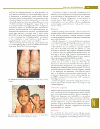 is usually not present until after 2-4 days of illness. The
triad of fever, headache and rash is observed in only half
of the patients. In spotted fever, rash is initially discrete
pale rose red blanching macules or maculopapules on the
extremities. Later, the rash spreads rapidly to involve the
entire body including palms and soles and becomes more
petechial sometimes with palpable purpura (Fig. 10.14).
In severe form of the disease, petechiae may enlarge into
ecchymosis, which can become necrotic. Severe vaso­
occlusive disease secondary to rickettsial vasculitis and
thrombosis is infrequent but can result in gangrene of the
digits, toes, earlobes, scrotum, nose or entire limbs
(Fig. 10.15). In scrub typhus, rash isseeninitially on trunk
or may not be present at all. Painless eschar, may be seen
at the initial site of tick attachment and regional
lymphadenopathy and is seen in scrub typhus.
Complications may involve any organ system and
include encephalopathy, pulmonary edema, myocarditis,
acute renal failure and vascular collapse.
Fig. 10.14: Maculopapular rash on the soles. Courtesy, Dr Atul Kulkarni,
Sholapur
Fig. 10.15: Necrotic rash in spotted fever. Note the gangrene of ear
lobes and fingers. Courtesy: Dr Atul Kulkarni, Sholapur
Infections and Infestations -
In Q fever no vector is involved. Transmission is by
inhalation ofinfecteddustfromsoil previouslycontaminated
by urine or feces of diseased animals. This fever is rarely
reported in children. This presents in acute as well as
chronic forms. Rash which is typical of variants of
rickettsial fever isnot seen inQfever. Pneumonia, hepatitis
and meningitis are other features. Endocarditis is seen in
chronic variety.
Diagnosis
Laboratoryfindings are nonspecific. Totalleukocytecount
may be initially normal or low but leukocytosis develops
as the disease progresses. Anemia, thrombocytopenia,
hyponatrernia and elevated serum aminotransferases are
some other features.
Specific diagnosis of a rickettsial illness is confirmed
by serological testing. Serological evidence of infection
occurs not earlier than the second week of illness in any
of the rickettsial diseases and hence a specific diagnosis
may not be available until after the patient has fully
recovered or worsened. Serodiagnosis ofrickettsialdisease
is possible using the immunoflourescence assay for
detection of IgG and IgM. However, it is expensive and
not widely available. ELISA is specific and sensitive
allowing detection of IgG and IgM antibodies.
Detection of IgM antibodies to scrub typhus and Indian
spotted fever is available in India. The Weil-Felix test
depends on detection of antibodies to various Proteus
species containing antigen with cross reacting epitopes to
antigens from members of the genus Rickettsia. It is widely
available but unacceptable for accurate diagnosis because
of low sensitivity and specificity. Weil-Felix test can be
used in developing countries where other tests are not
available for diagnosis of rickettsia infection but the test
should be interpreted in conjunction with history and
clinical presentation.
If clinical suspicion for rickettsia is high, then empirical
therapy should be started without waiting for any
confirmatory test.
Differential Diagnosis
Spottedfever can mimic a great numberof febrile illnesses.
Most important of these are meningococcernia, measles
and enteroviral exanthemas. Other diseases included in
differential diagnosis are typhoid fever, secondary
syphilis, leptospirosis, toxic shock syndrome, scarlet fever,
rubella, Kawasaki disease, parvoviral infection, idiopathic
thrombocytopenic purpura, thrombotic thrombo­
cytopenic purpura, hemolytic uremic syndrome, Henoch­
Schonlein purpura, hepatitis, dengue fever, infectious
mononucleosis and malaria.
Treatment
Doxycycline is the drug of choice for all age groups.
Chloramphenicol is reservedforpatientswithdoxycycline
allergy and for pregnant women. Doxycycline can be used
 
