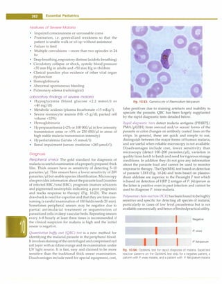 - Essential Pediatrics
Features of Severe Malaria
• Impaired consciousness or unrousable coma
• Prostration, i.e. generalized weakness so that the
patient is unable walk or sit up without assistance
• Failure to feed
• Multiple convulsions -more than two episodes in 24
hr
• Deep breathing,respiratory distress (acidotic breathing)
• Circulatory collapse or shock, systolic blood pressure
<70 mm Hg in adults and <50 mm Hg in children
• Clinical jaundice plus evidence of other vital organ
dysfunction
• Hemoglobinuria
• Abnormal spontaneous bleeding
• Pulmonary edema (radiological)
Laboratory findings of severe malaria
• Hypoglycemia (blood glucose <2.2 mmol/1 or
<40 mg/dl)
• Metabolic acidosis (plasma bicarbonate <15 mEq/1)
• Severe normocytic anemia (Hb <5 g/dl, packed cell
volume <15%)
• Hemoglobinuria
• Hyperparasitemia (>2% or 100 000/µl in low intensity
transmission areas or >5% or 250 000/µl in areas of
high stable malaria transmission intensity)
• Hyperlactatemia (lactate >5 mmol/1)
• Renal impairment (serum creatinine >265 µmol/1).
Diagnosis
Peripheral smear The gold standard for diagnosis of
malariais careful examination ofaproperlyprepared thick
film. Thick smears have as