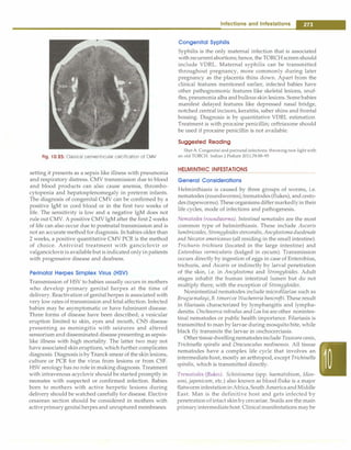 Paediatrics (8th Edition) [O.P. Ghai] .pdf