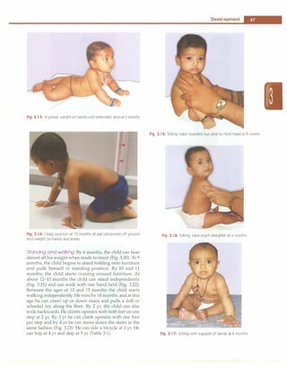 ___________________________________
o_ e_v_e _io_p_m_en_t
__
_
Fig. 3.13: In prone: weight on hands with extended arms at 6 months
Fig. 3.14: Creep position at 10 months of age (abdomen off ground
and weight on hands and knees
Standing and walking By 6 months, the child can bear
almost all his weight when made to stand (Fig. 3.20). At 9
months, the child begins to stand holding onto furniture
and pulls himself to standing position. By 10 and 11
months, the child starts cruising around furniture. At
about 12-13 months the child can stand independently
(Fig. 3.21) and can walk with one hand held (Fig. 3.22).
Between the ages of 13 and 15 months the child starts
walking independently. He runsby 18 months and at this
age he can crawl up or down stairs and pulls a doll or
wheeled toy along the floor. By 2 yr, the child can also
walk backwards. He climbs upstairs with bothfeet on one
step at 2 yr. By 3 yr he can climb upstairs with one foot
per step and by 4 yr he can move down the stairs in the
same fashion (Fig. 3.23). He can ride a tricycle at 3 yr. He
can hop at 4 yr and skip at 5 yr (Table 3.1).
Fig. 3.15: Sitting; back rounded but able to hold head at 8 weeks
Fig. 3.16: Sitting; back much straighter at 4 months
Fig. 3.17: Sitting with support of hands at 6 months
 