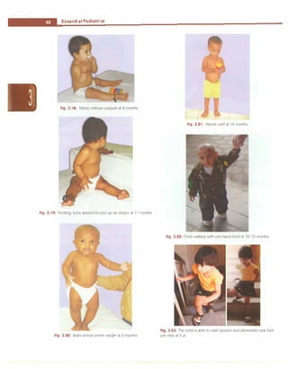 ___E_s_s_ e_
n_t_ia_i_P_e _d_ia.t.ri_c_
s _________________________________ _
Fig. 3.18: Sitting without support at 8 months
Fig. 3.19: Pivoting; turns around to pick up an object at 11 months
Fig. 3.20: Bears almost entire weight at 6 months
Fig. 3.21: Stands well at 12 months
Fig. 3.22: Child walking with one hand-held at 12-13 months
Fig. 3.23: The child is able to walk upstairs and downstairs one foot
per step at 4 yr
 