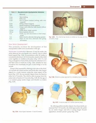 --------------------------------------0-e_v_e_io_p_m_e_n_t __
Table 3.1: Key gross motor developmental milestones
Age
3mo
Smo
6mo
8mo
9mo
12mo
15mo
18mo
2yr
3yr
4 yr
Milestone
Neck holding
Rolls over
Sits in tripod fashion (sitting with own
support)
Sitting without support
Stands holding on (with support)
Creeps well; walks but falls; stands without
support
Walks alone; creeps upstairs
Runs; explores drawers
Walks up and downstairs (2 feet/step);
jumps
Rides tricycle; alternate feet going upstairs
Hops on one foot; alternate feet going
downstairs
Fine Motor Development
This primarily involves the development of fine
manipulation skills and coordination with age.
Hand eye coordination Between 12 and 20 weeks, the
child observes his own hands very intently, this is called
hand regard (Fig. 3.24). Its persistence after 20 weeks is
considered abnormal. At 3 to 4 months, hands of the child
come together in midline as he plays (Fig. 3.25). If a red
ring is dangled in front of him, he fixes his attention on it,
and then tries to reach for it (Fig. 3.26). Initially he may
overshoot but eventually he gets it and brings it to his
mouth.
Grasp is best assessed byofferinga red cube to the child.
A 6-month-old infant reaches and holds the cube (larger
object) in a crude manner using the ulnar aspect of his
hand (Fig. 3.27). He can transfer objects from one hand to
other by 6-7 months. The child is able to grasp from the
radial side of hand at 8--9 months (Fig. 3.28). By the age of
1 yr mature grasp (index finger and thumb) is evident
(Fig. 3.29).
Fig. 3.24: Hand regard (between 12 and 20 weeks)
Fig. 3.25: The child brings hands in midline as he plays at 3 to
4 months of age
Fig. 3.26: Bidextrous grasp approach to a dangling ring at 4 months
Fig. 3.27: Immature grasp at 6 months (palmar grasp)
By offering pellets (smaller object), finerhand skills are
assessed. By 9-10 months, the child approaches the pellet
by an index finger and lifts it using finger thumb
apposition, termed 'pincer' grasp (Fig. 3.30).
 