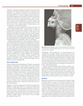 Paediatrics (8th Edition) [O.P. Ghai] .pdf