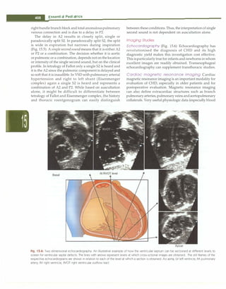 Paediatrics (8th Edition) [O.P. Ghai] .pdf