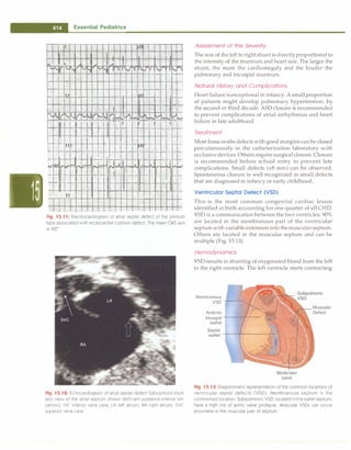 Paediatrics (8th Edition) [O.P. Ghai] .pdf