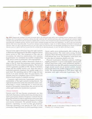 Paediatrics (8th Edition) [O.P. Ghai] .pdf