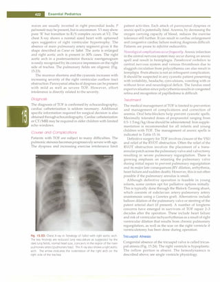 Paediatrics (8th Edition) [O.P. Ghai] .pdf