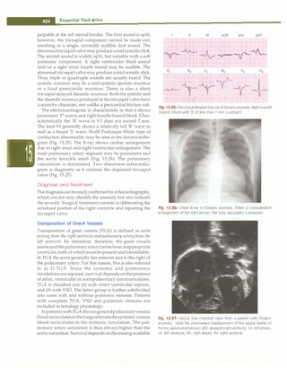 Paediatrics (8th Edition) [O.P. Ghai] .pdf