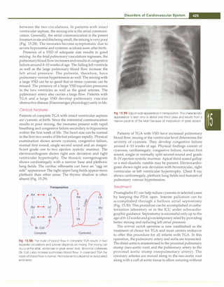 Paediatrics (8th Edition) [O.P. Ghai] .pdf