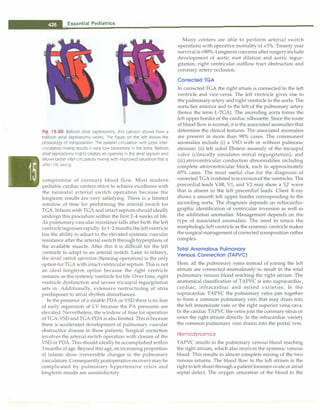 Paediatrics (8th Edition) [O.P. Ghai] .pdf