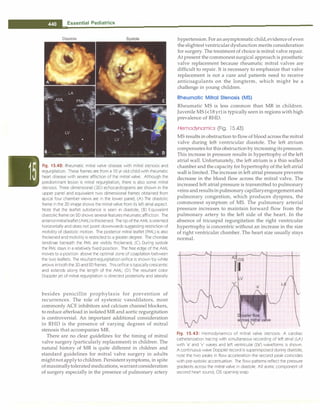 Paediatrics (8th Edition) [O.P. Ghai] .pdf