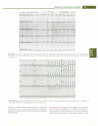 Paediatrics (8th Edition) [O.P. Ghai] .pdf
