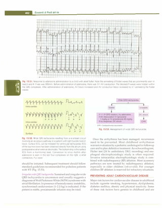 Paediatrics (8th Edition) [O.P. Ghai] .pdf