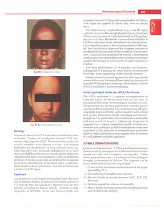 Paediatrics (8th Edition) [O.P. Ghai] .pdf