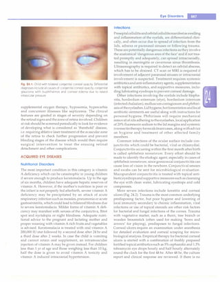 Paediatrics (8th Edition) [O.P. Ghai] .pdf