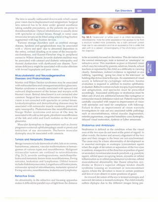 Paediatrics (8th Edition) [O.P. Ghai] .pdf