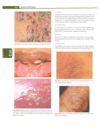 Paediatrics (8th Edition) [O.P. Ghai] .pdf