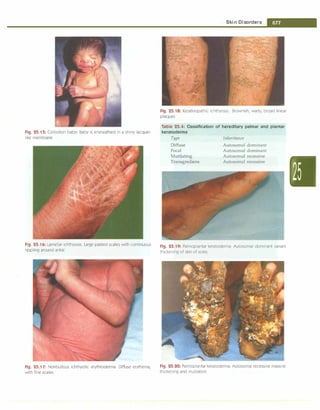 Paediatrics (8th Edition) [O.P. Ghai] .pdf