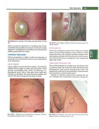 Paediatrics (8th Edition) [O.P. Ghai] .pdf