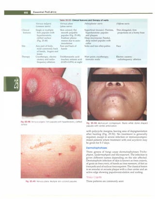 Paediatrics (8th Edition) [O.P. Ghai] .pdf