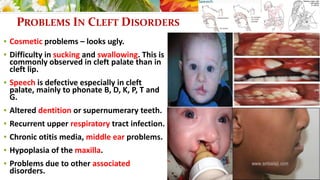 Pediatric Surgery 2 - Cleft lip & palate / TOF / Hypospadias ...