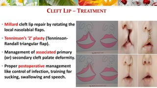 Pediatric Surgery 2 - Cleft lip & palate / TOF / Hypospadias ...