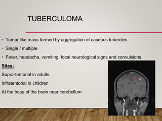 paediatric TB.pptx