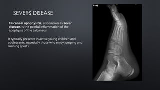 PAEDIATRIC TRAUMA AND SCLEROSING DYSPLASIA.pptx