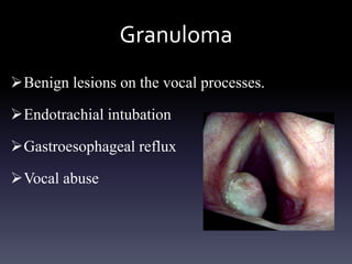 Voice Problems Paediatric voice disorders | PPTX