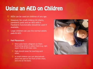  AEDs can be used on children of any age.
 However, for small children & infants,
paediatric pads and an AED with a
Paediatric functionality should be used if
available.
 Large children can use the normal adults
pads & AED.
 Pad Placement
 Most pads have a diagram on them
illustrating where to place them (e.g. right
upper chest & left lower side).
 Pads should never be touching each
other.
 In small children you can alternatively
place one pad on the front of the chest,
and one on the back.
 