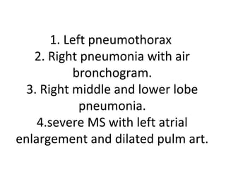 Paeds chest x ray | PPT