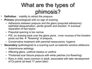 Paediatric Urology [Dr.Edmond Wong] | PPT