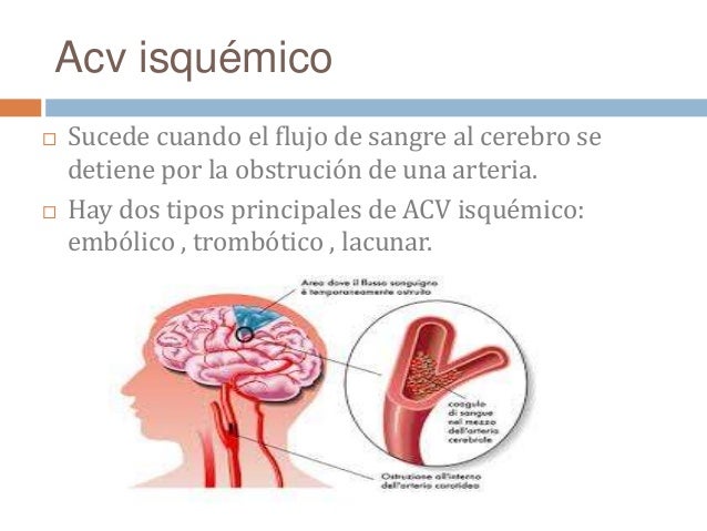 Dura cuanto la baja temporal después de la desaparición de las venas varicosas