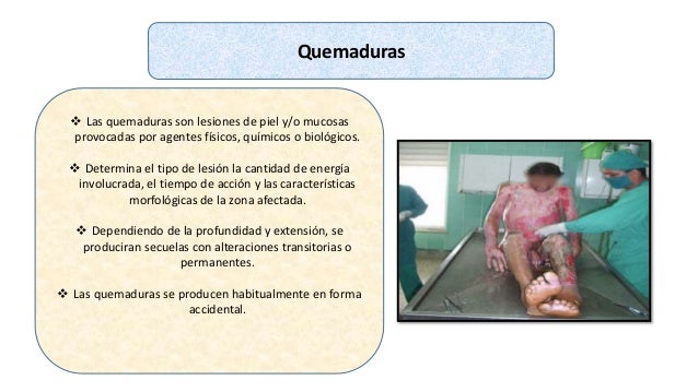 cuidados de enfermería en pacientes quemados