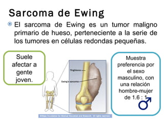 Sarcoma de Ewing
   El sarcoma de Ewing es un tumor maligno
    primario de hueso, perteneciente a la serie de
    los tumores en células redondas pequeñas.

 Suele                                   Muestra
afectar a                            preferencia por
 gente                                   el sexo
 joven.                              masculino, con
                                      una relación
                                     hombre-mujer
                                        de 1.6 : 1
 