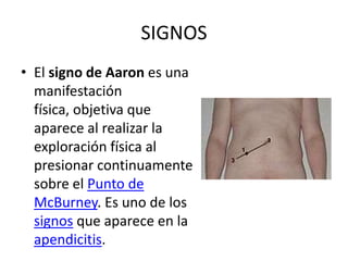 SIGNOS
• El signo de Aaron es una
manifestación
física, objetiva que
aparece al realizar la
exploración física al
presionar continuamente
sobre el Punto de
McBurney. Es uno de los
signos que aparece en la
apendicitis.
 