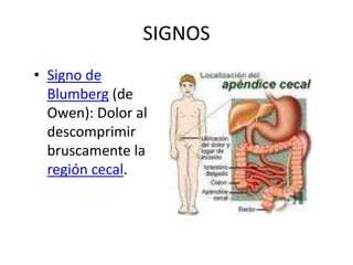 SIGNOS
• Signo de
Blumberg (de
Owen): Dolor al
descomprimir
bruscamente la
región cecal.
 