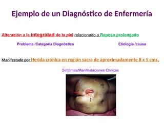 Ejemplo de un Diagnóstico de Enfermería
Alteración a la integridad de la piel relacionado a Reposo prolongado
Manifestado por Herida crónica en región sacra de aproximadamente 8 x 5 cms.
Etiología /causa
Problema /Categoría Diagnóstica
Síntomas/Manifestaciones Clínicas
 