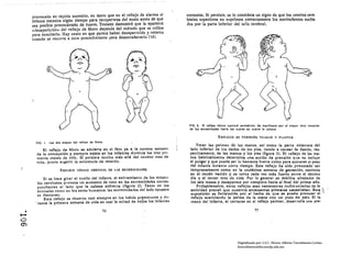 provocado en rápida sucesión, en tanto que en el reflejo de alarma t:1            nonuales. SI persiste, se lo considera un signo de que los centros cere.
         infante necesita algún tiempo para recupe~rse del susto antes de que              brales superiores no suprhnen correctamente los movimientos media.
         sea posible provocárse)o de nuevo. Touwen demostró que la aparente                dos por la parte Inferior de) tallo. cerebral.
         «desaparición .. del reflejo de Moro depende de) método que se utilice
         para suscitarlo. Hay casOs en que parece haber desapar,!cido y retorna
         cuando se recurre a otro procedimiento para desencadenarlo (16).




                                                                                            FIG. 2. El rellelo lónlco corvlcal ulm61rlco, So manifiesta por el mayor lono muscular
                                                                                            de lu exlrllmldadlll hacia lu cuales la vuelvo la cabeu.

                                                                                                              REPtruoS DE! PRENSIÓN PALMAR y PLANTAR
           flG. 1.   lu dOI otapu del rollelo do Moro.
                                                                                                 Tocar las palmas dU las manos, asl como la parte delantera del
              El reflejo do Moro se advierte en el feto ya a la novenn seman:l               lado Inferior de los dedos de los pies. tiende a causar la flexión, res·
           de 111 concepción y siempre existe en los Infantes durnnte los troa pri.          pectlvamente, de las manos y los pies (figura 3), El reflejo de las ma'
           meros meses de vld¡,. SI persiste mucho más allá del noveno mes de                nos habitualmente determIna una acción de prenslón q lIe no Incluye
           vida, puc:dc: sugerir la existencia de retardo,                                   el pulgar y que puede ser 10 bastante fuerte como para sostener el peso
                                                                                             del Infunte durante corto tiempo. Este reflejo ha sido provocado tan
                           REI'LaJO fÓNICO CERVICAL DI! LAS I!.XTRI!MlDADI!S                 tempranamente como en la undécima semana de gestación, contlm'¡a
                                                                                             en el recién nacido y se torna cada vez más fuerte en Ire el décimo
                 Si se hace girar el cuello del Infante, el estl ramlento de los mllscu,     dla y el tercer mes de vida. Por lo general se debilita alrededor de
            los cervicales provoca un aumento de tono en las extremidades corres­            los seis meses y desaparece por completo hacia el final del primer af¡o,
            pondientes ni lado que la cabeza enfrerlta (figura 2). Tanto en los                  Probablemente, estos reflejos sean remanentes nldlmentarios de la
            anlmllles comO en los seres humanos, las extremidades del lado opuesto           actividad prensil que nuestros antecesores primates neccsltaban, Ella
            51:1 tlexlonan.
                                                                                             suposición el fortalecida por el hecho de que se puede provocar el
                 E.ste reflejo se observa cnsl siempre en los bob¿s pr~mnluros y du­          reflejo acariciando la palma de la mano con un poco de pelo. SI la
          . nnte la primera semana de vida en casi la mitad de tocIos los Infantes            mano del 'Infante, al cerrarse en el reflejo palmar, deaar¡'olla una pre­

    •
......
                                                     76                                                                               77

O
O')




                                                                                                                           Digitalizado por: I.S.C. Hèctor Alberto Turrubiartes Cerino
                                                                                                                           hturrubiartes@beceneslp.edu.mx
 