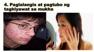 4. Paglalangis at pagtubo ng
taghiyawat sa mukha
 