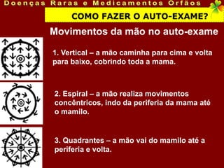 COMO FAZER O AUTO-EXAME?
Movimentos da mão no auto-exame

1. Vertical – a mão caminha para cima e volta
para baixo, cobrindo toda a mama.



2. Espiral – a mão realiza movimentos
concêntricos, indo da periferia da mama até
o mamilo.


3. Quadrantes – a mão vai do mamilo até a
periferia e volta.
 